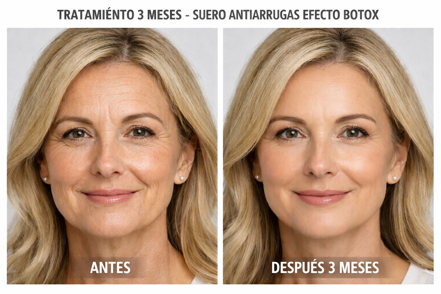 Suero antienvejecimiento con solución concentrada tipo bótox